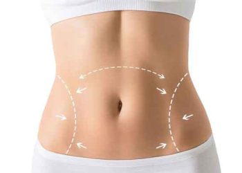 همه چیز درباره ابدومینوپلاستی